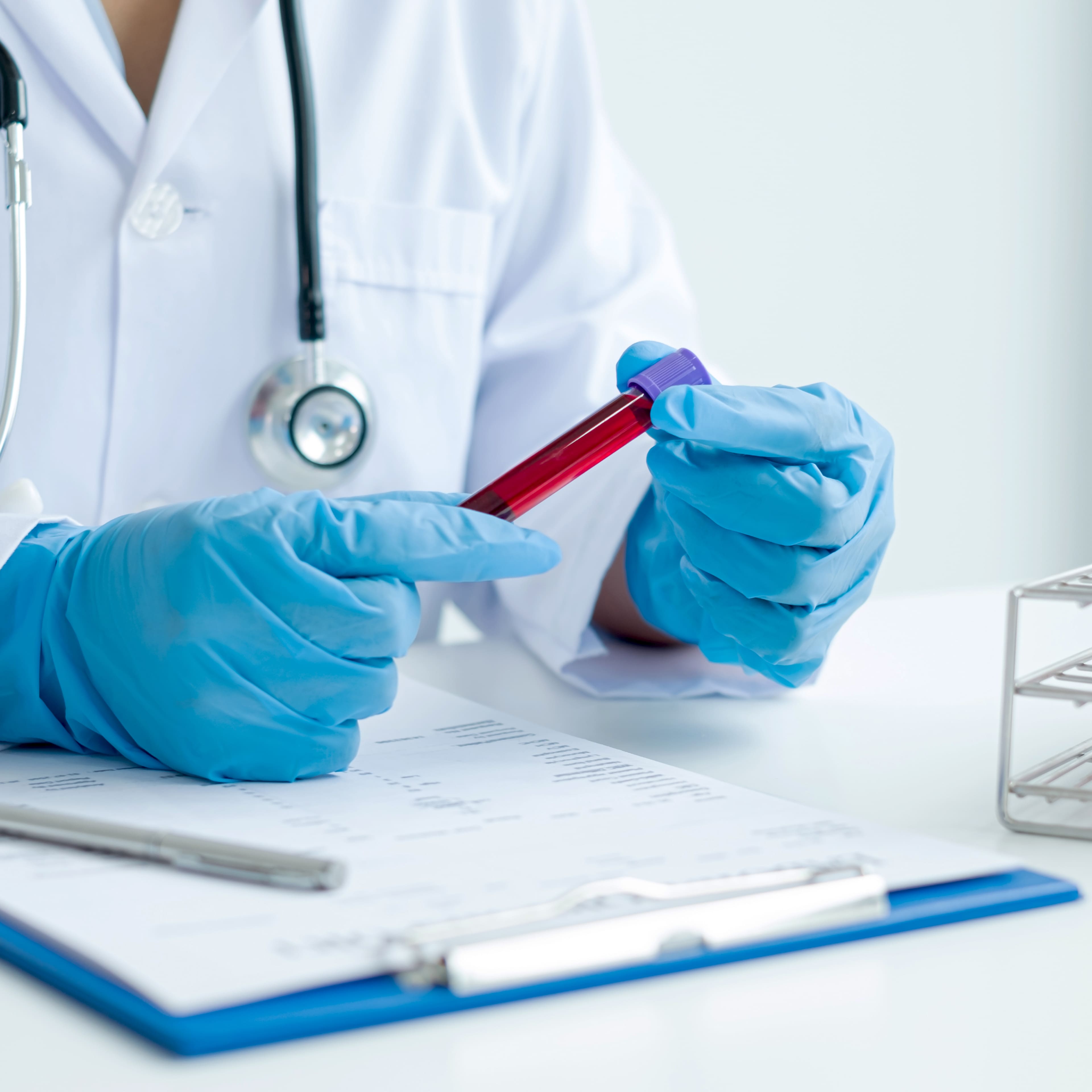 Nouveau test sanguin récidive cancer du sein